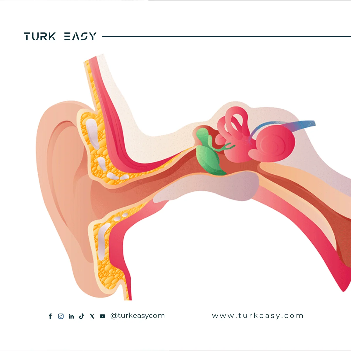 Chirurgie de lacoustique neurinome 2024 | Turk Easy