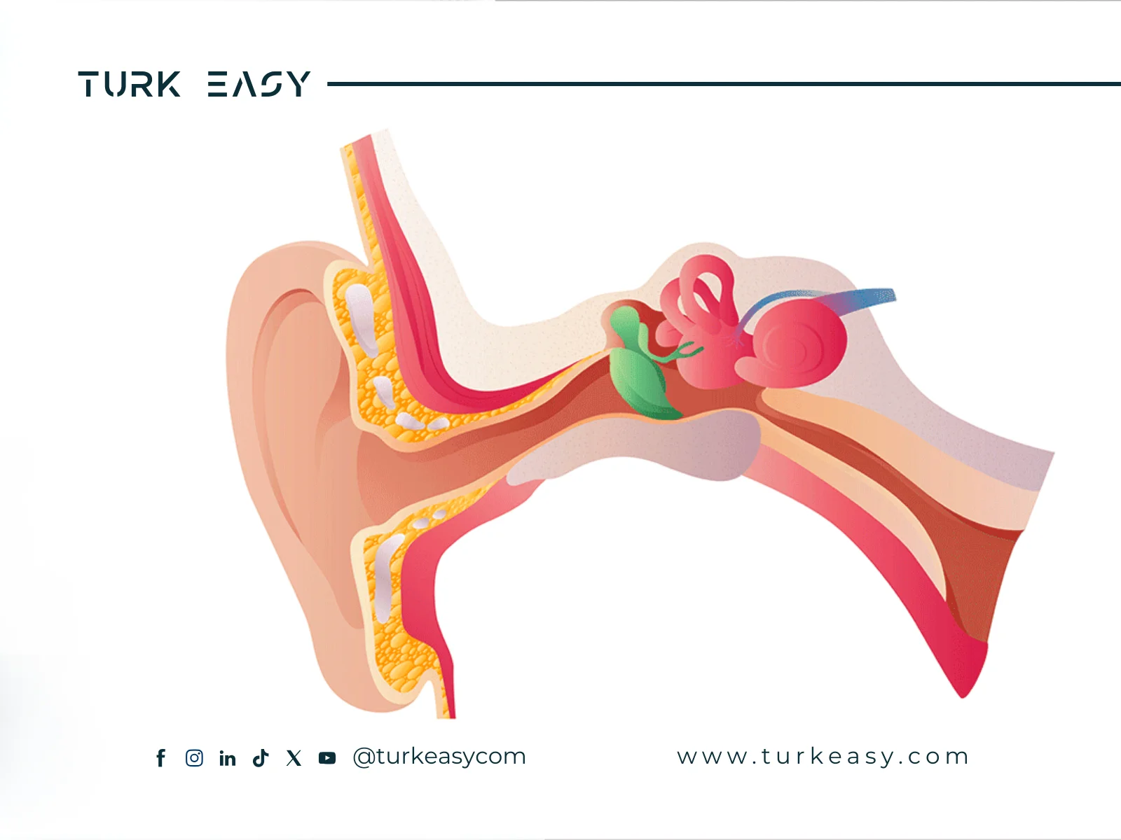 Хирургия опухоли слухового нерва 2024 | Turk Easy
