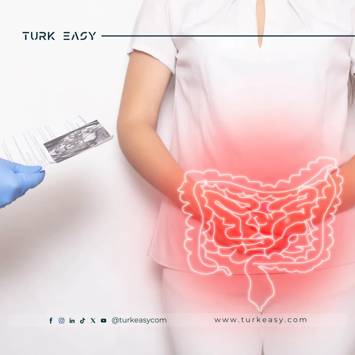 Intestinal Cancer Surgery 2024 |  Turk Easy 