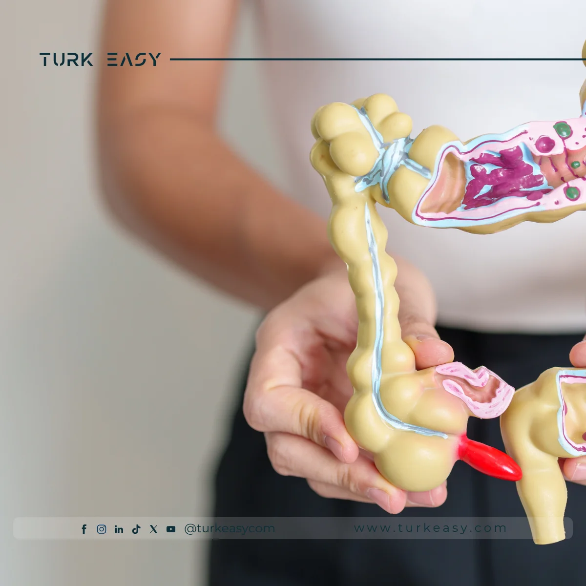 Résection du côlon et du rectum 2024 |  Turk Easy 