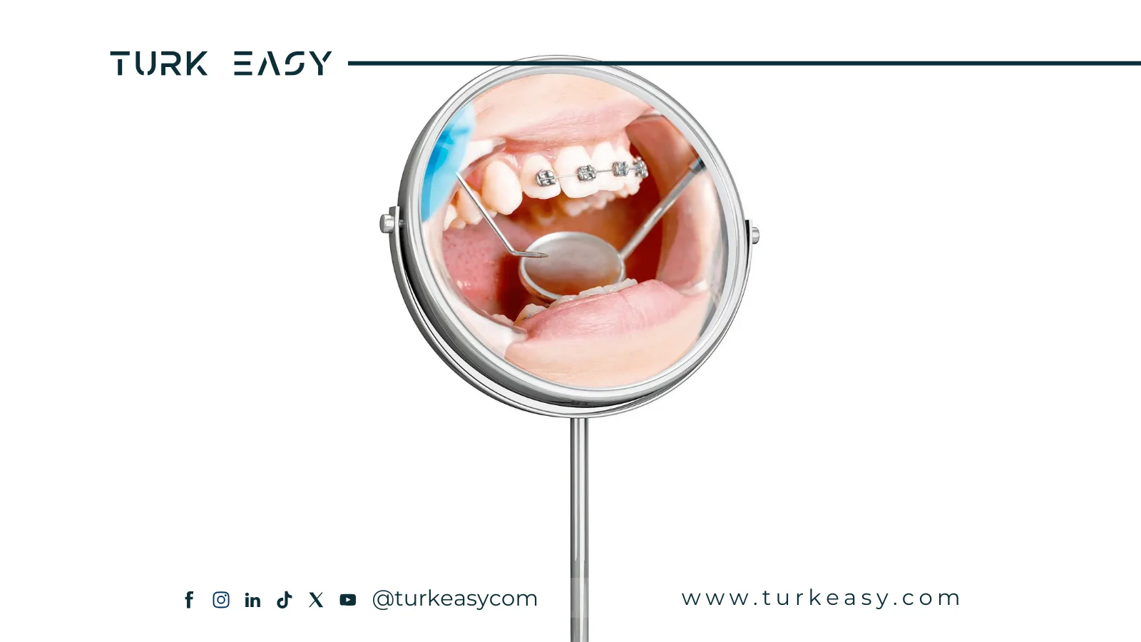 Understanding Dental Braces 2024 | Turk Easy