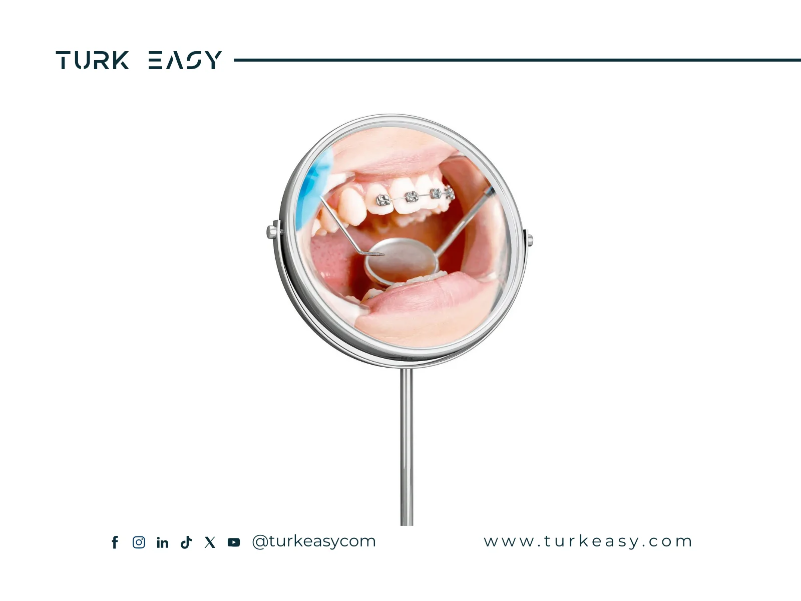 Understanding Dental Braces 2024 | Turk Easy