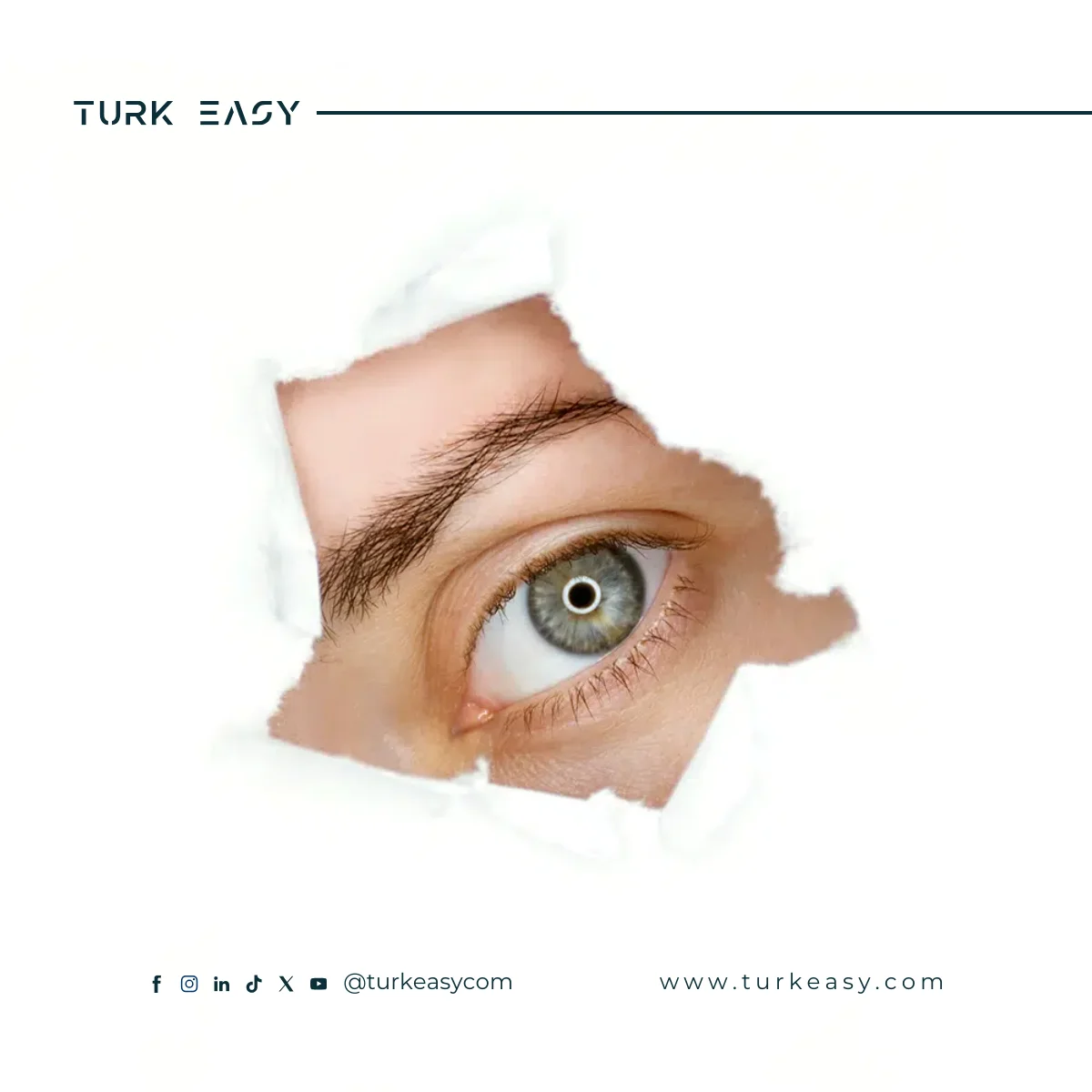 جراحة الزرق 2024 | Turk Easy