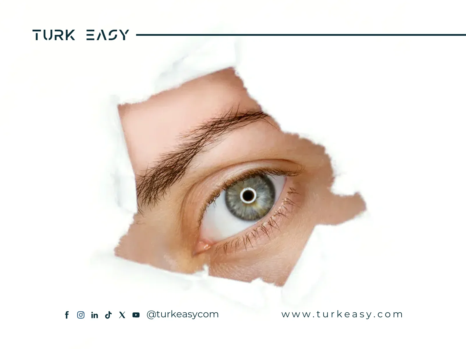 جراحة الزرق 2024 | Turk Easy