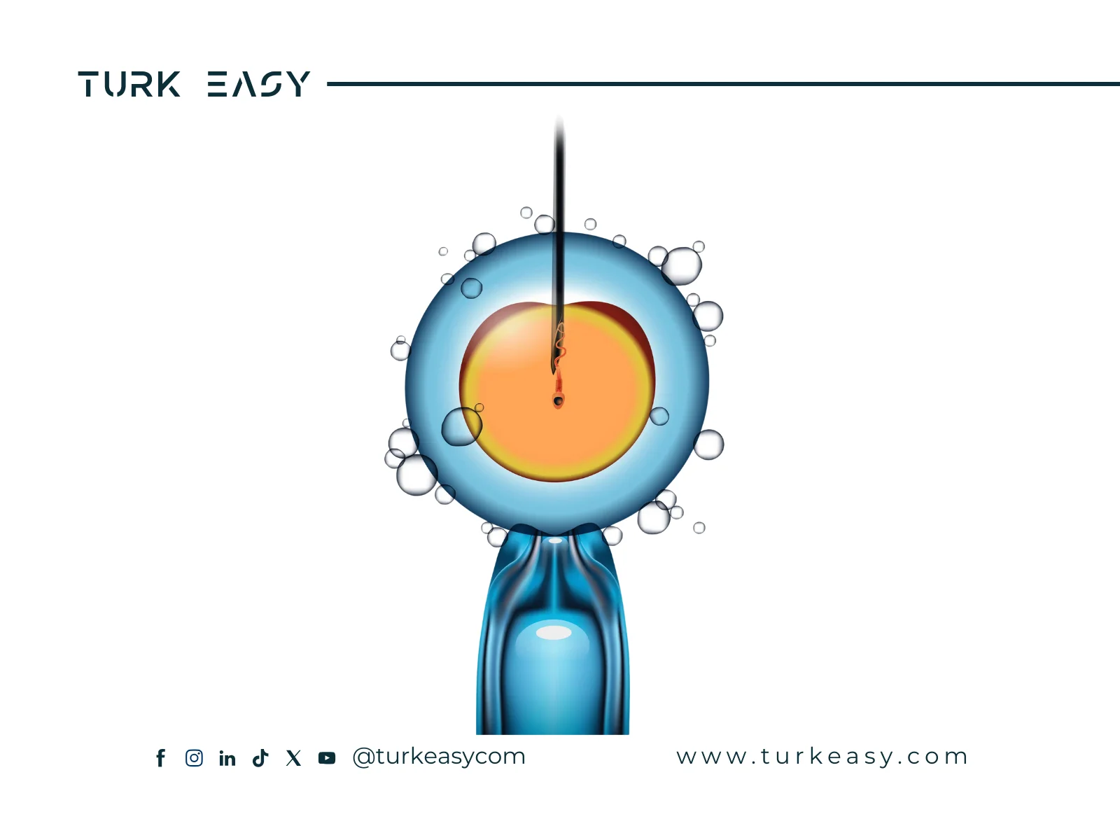 الحقن المجهري 2024 | Turk Easy