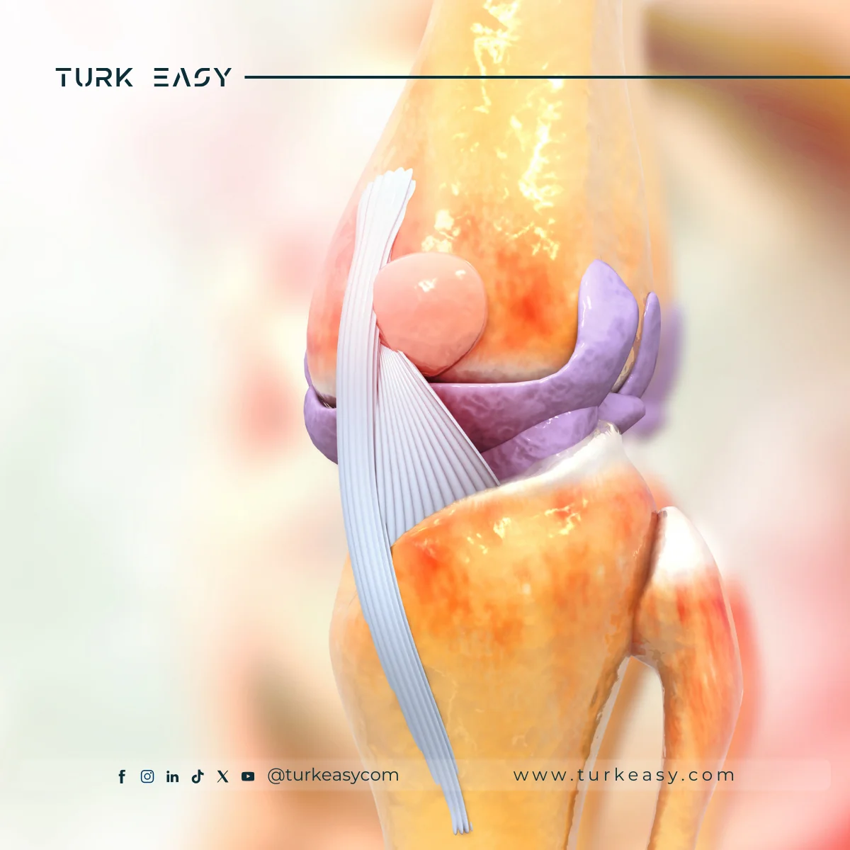 Хірургія заміни суглобів 2024 | Turk Easy