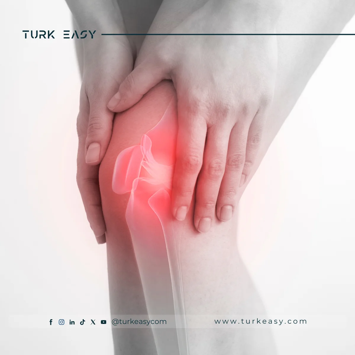 Операція з заміни колінного суглоба 2024 | Turk Easy