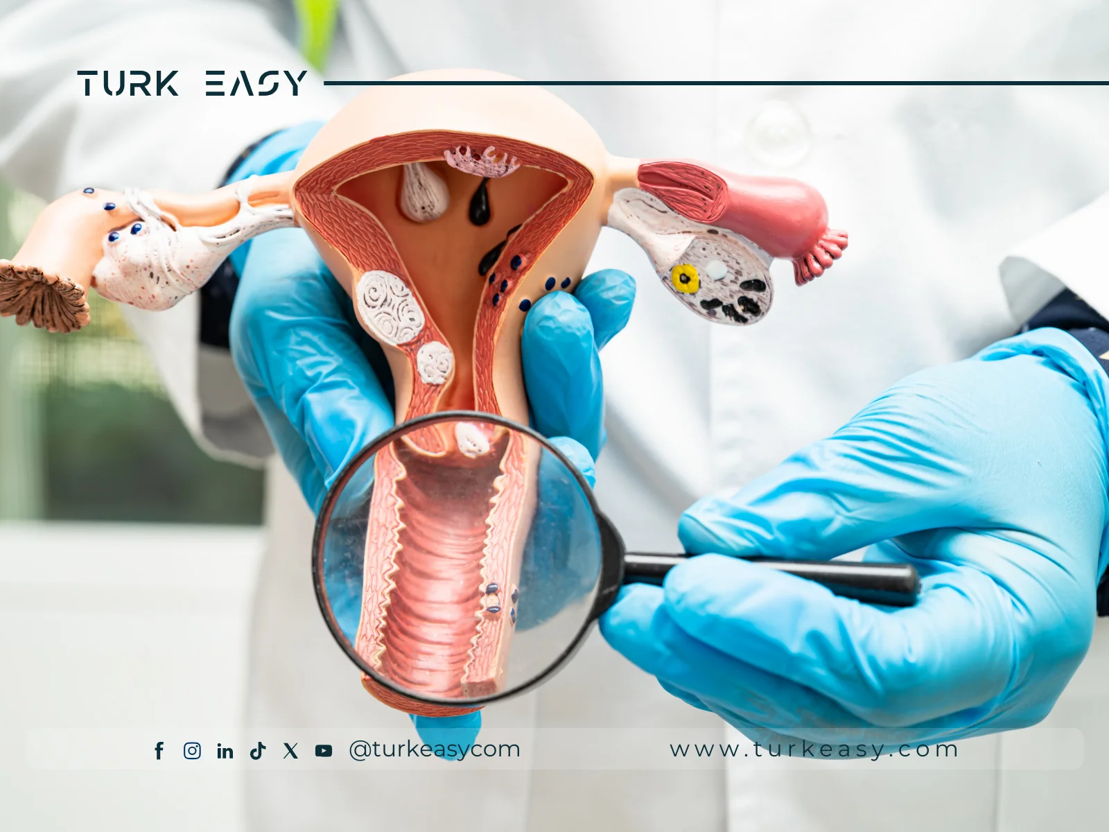Ligature tubaire laparoscopique 2024 | Turk Easy