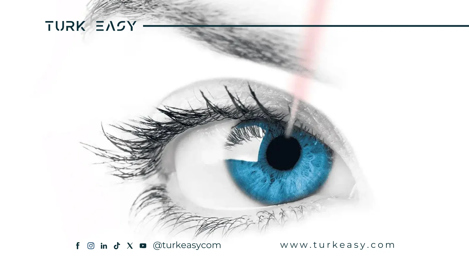 Understanding LASIK Eye Surgery: Benefits and Procedure
