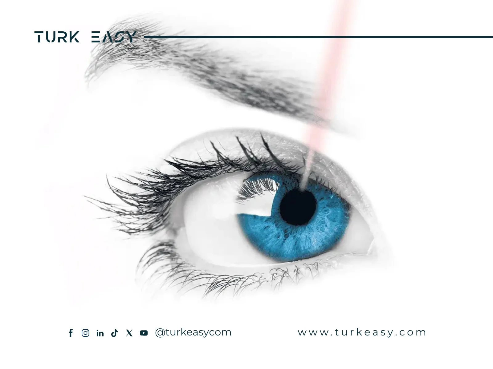 Comprendre la chirurgie oculaire LASIK : avantages et procédure