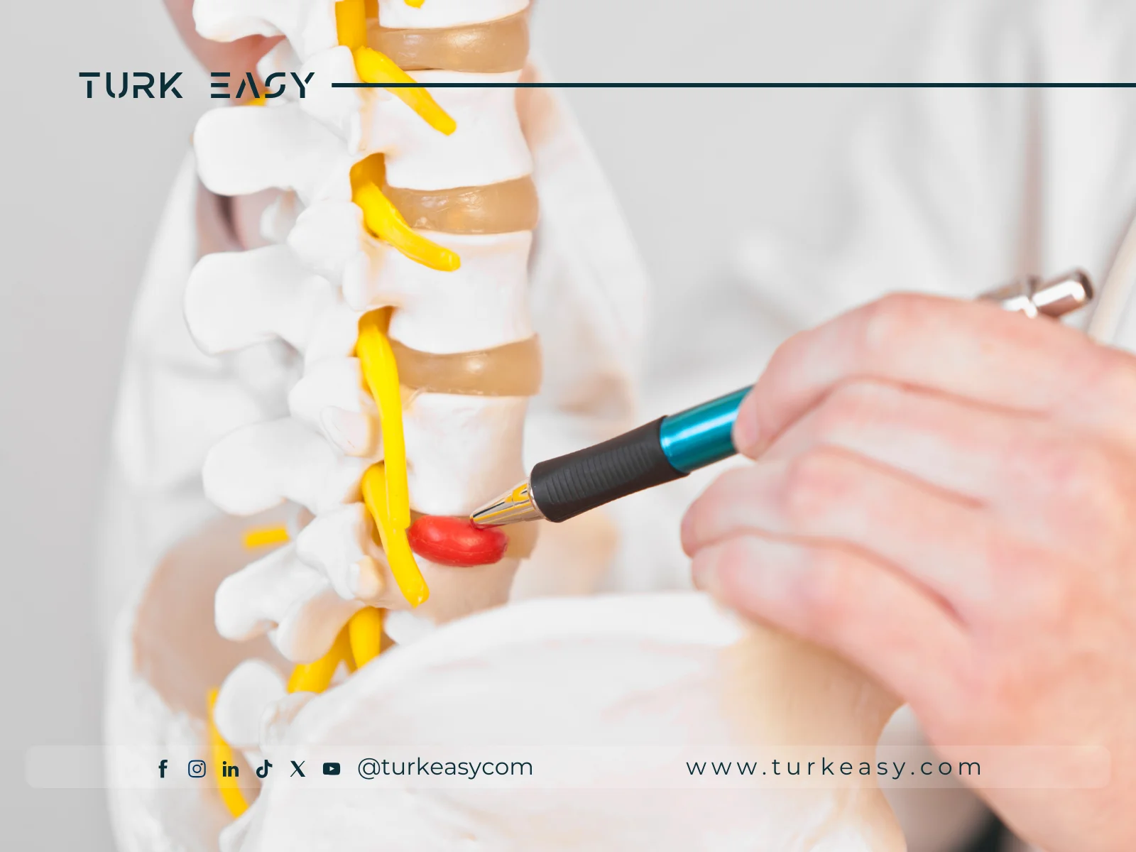 Хірургія при грижі міжхребцевого диска 2024 | Turk Easy