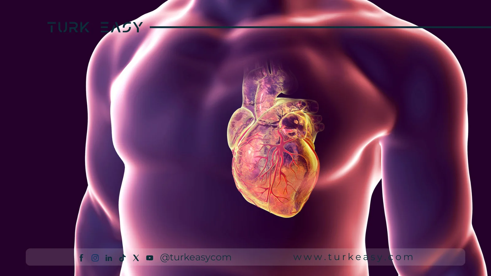 Pontage coronarien à cœur ouvert 2024 | Turk Easy