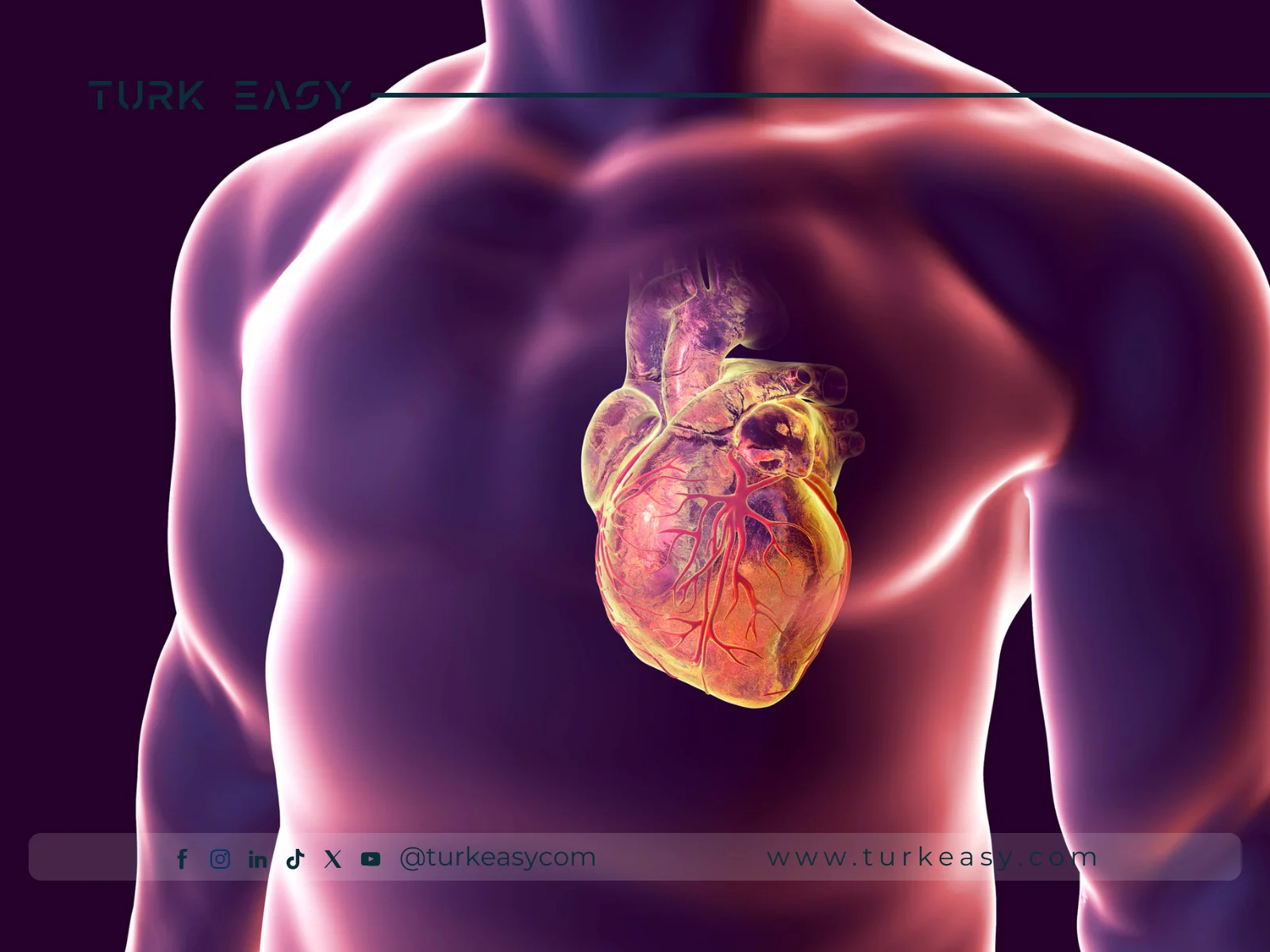 Pontage coronarien à cœur ouvert 2024 | Turk Easy