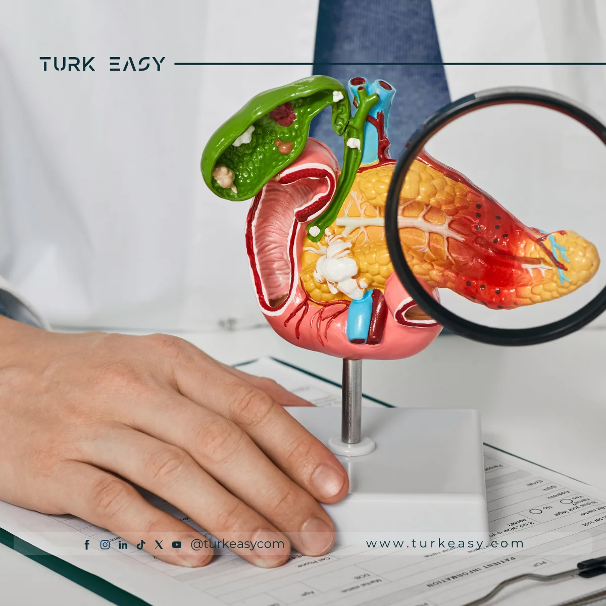 Хирургия рака поджелудочной железы 2024 |  Turk Easy 