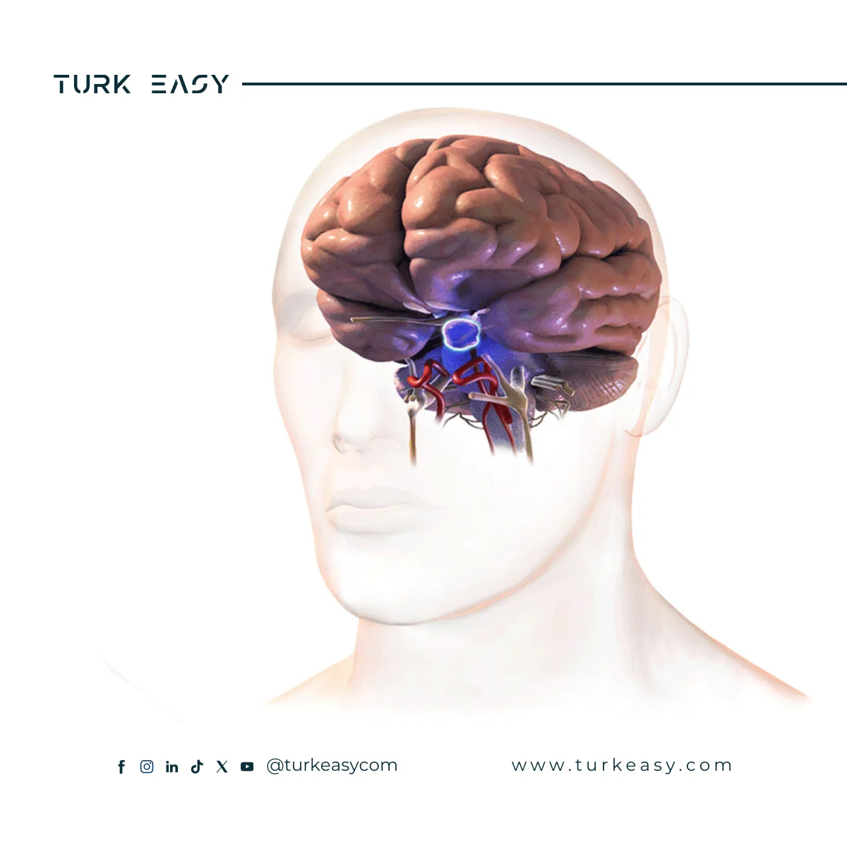 Pituitary Tumor 2024 | Turk Easy