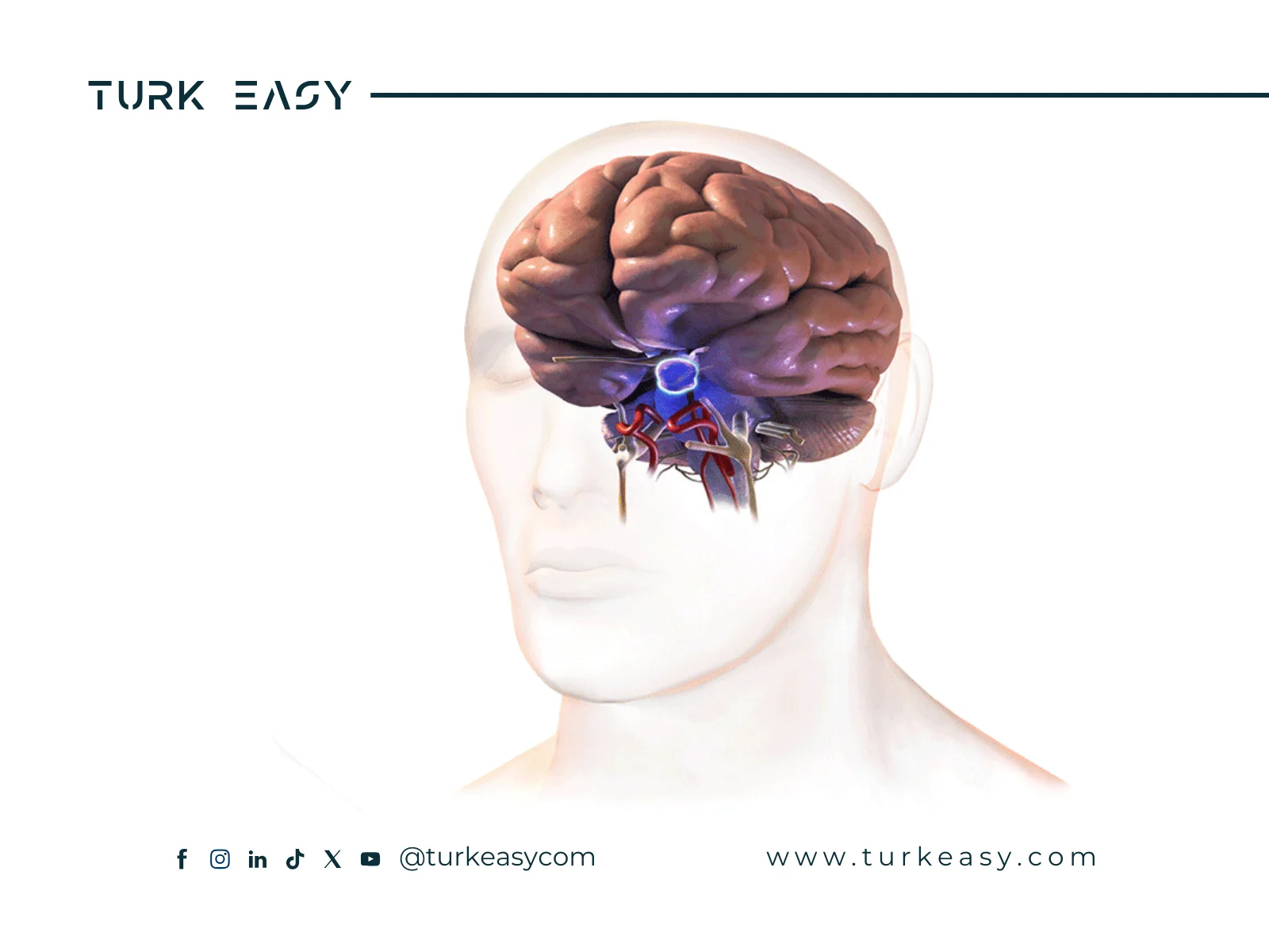 Пухлина гіпофізу 2024 | Turk Easy