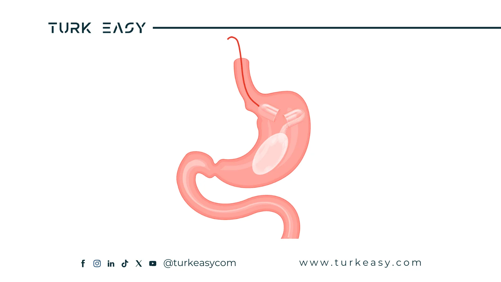 Розумна капсула для лікування ожиріння 2024 | Turk Easy