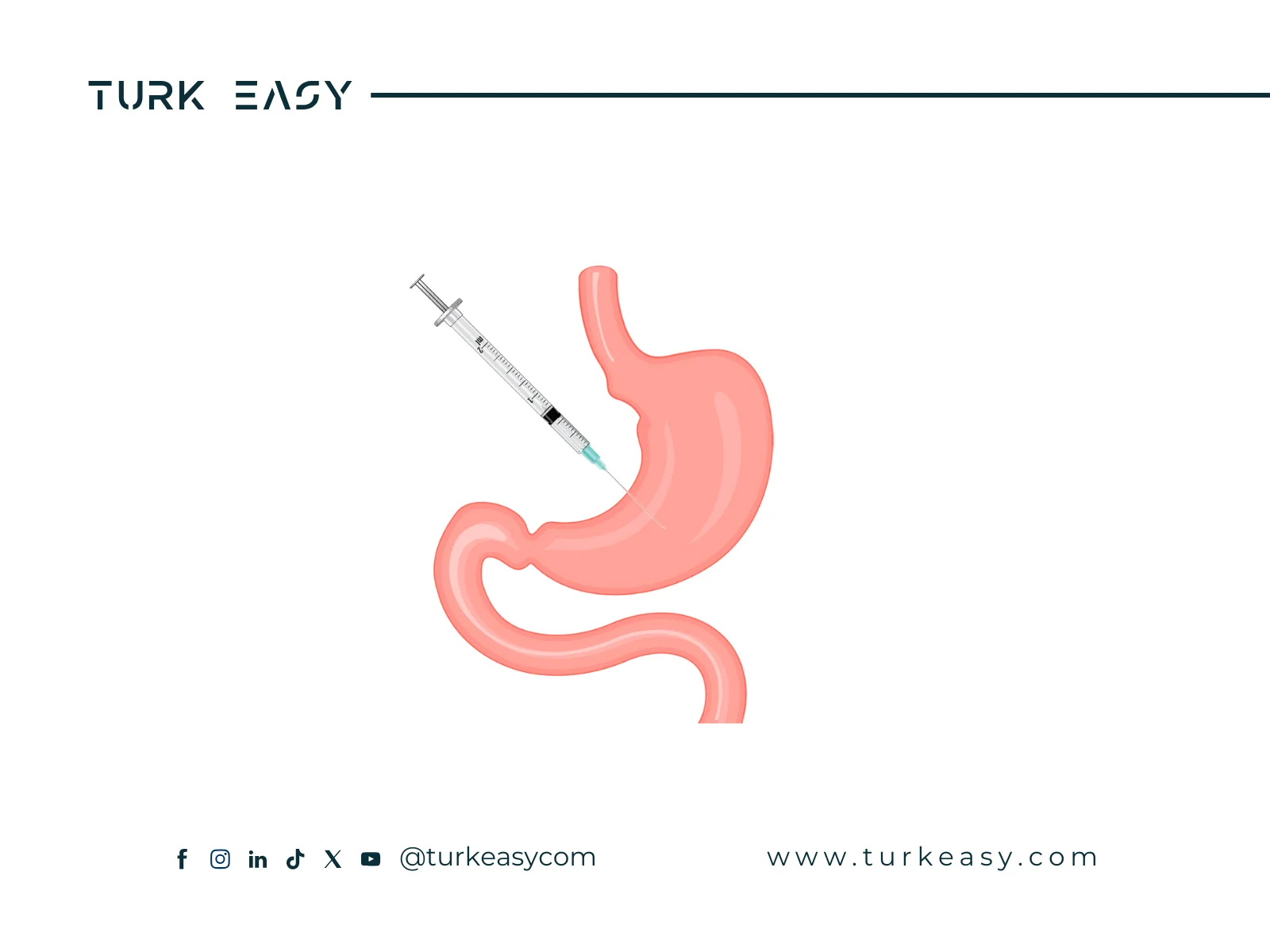Gastric Botox 2024 | Turk Easy
