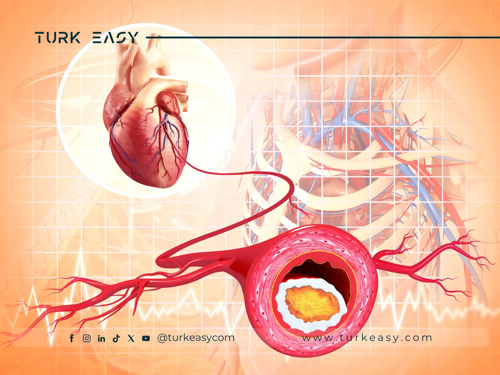 Transposition des grandes artères 2024 | Turk Easy